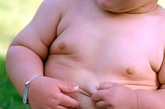 Ako liečiť detskú obezitu doma