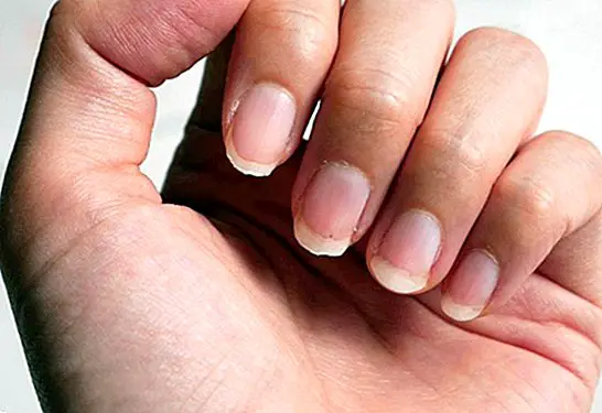 Przyczyny słabych paznokci i zabiegi wzmacniające je