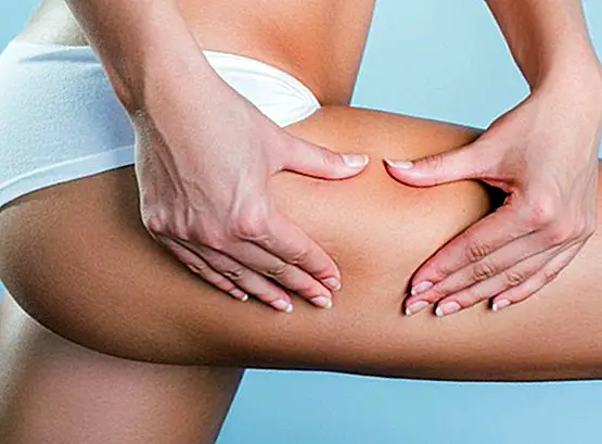 How to eliminate cellulite: tips, self-massage and 3 exercises - beauty