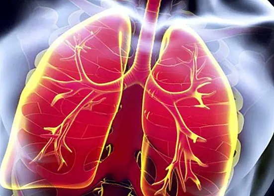 Terveet tavat, jotka auttavat meitä estämään keuhkokuume