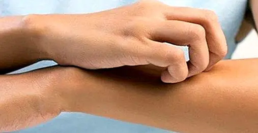 How to relieve itchy skin naturally - healthy tips
