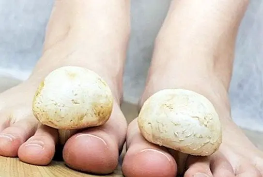 How to treat fungi on the feet: natural care and advice - healthy tips