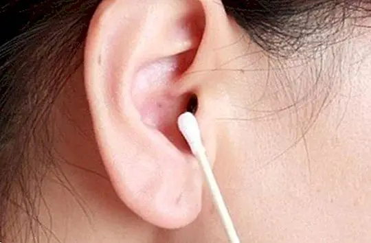 耳の中のCerumen：ワックスを簡単に除去するためにすべきこと - 健康的なヒント