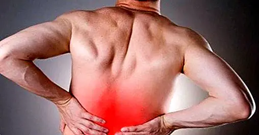 How to calm sciatica pain naturally - healthy tips