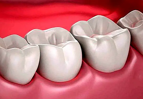 Quais são os dentes do siso usados ​​e por que eles são chamados - curiosidades
