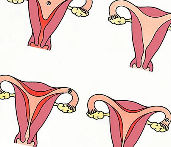 Como é o ciclo menstrual das mulheres