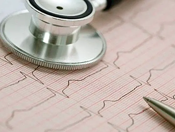 Alarm symptoms of an arrhythmia and recommendations when having it - curiosities