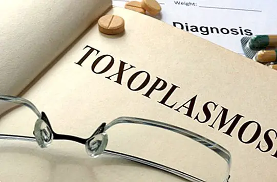 bolezni - Toksoplazmoza: simptomi, vzroki, okužba in kako se ji izogniti