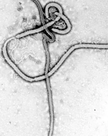 Ебола: какво е това, симптоми, диагноза, причини и лечение
