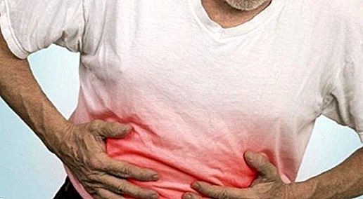 Ziekte van Crohn: wat het is, symptomen en oorzaken
