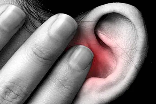 Como saber se você tem um plugue de cera nos ouvidos: sintomas - doenças