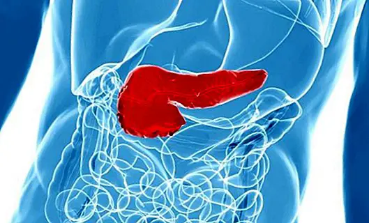 Pancreatite: sintomas, causas e tratamento - doenças