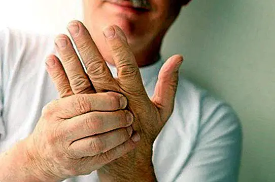 Waarom vallen onze armen, handen en voeten in slaap? - ziekten