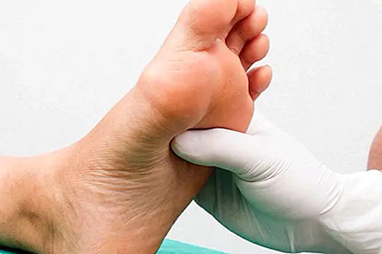 Kako skrbeti za diabetično stopalo in nasvete, da bi se izognili zapletom