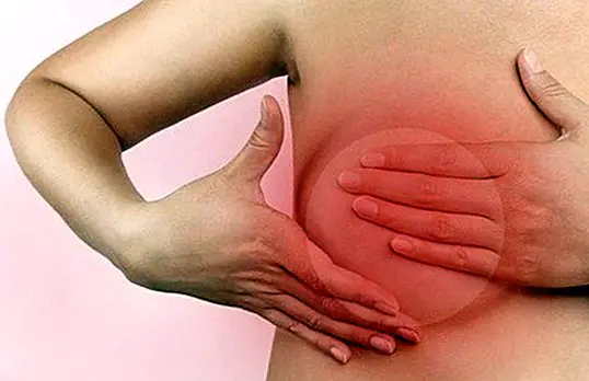 Puerperāls mastīts: simptomi, cēloņi un ārstēšana - Zīdīšana