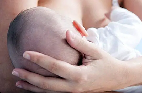 Síndrome de confusão mamilo e quando usar uma bomba de mama - lactância Materna