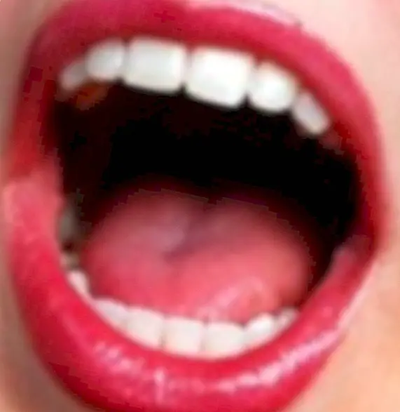 Kako imati zdrava usta