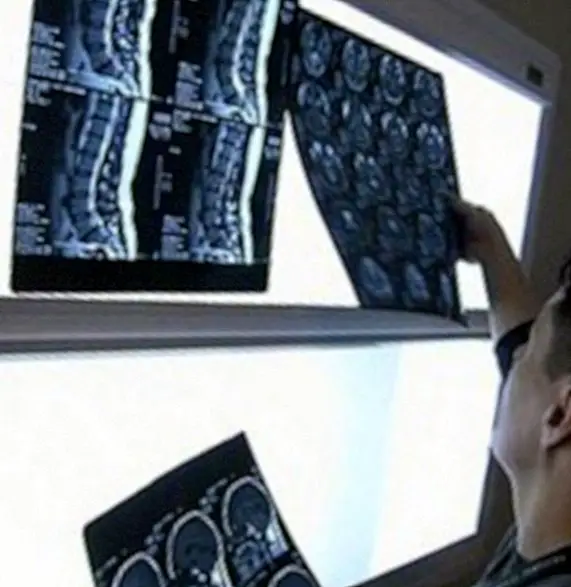 Učinki rentgenskih testov na zdravje - medicinske preiskave