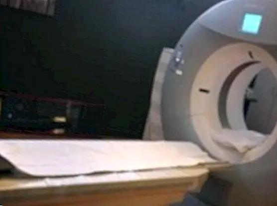Reduzir os testes de raios X reduziria o risco de câncer em 62% - provas medicas