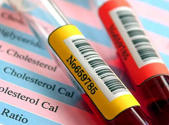 How to understand the results of a blood test - medical tests