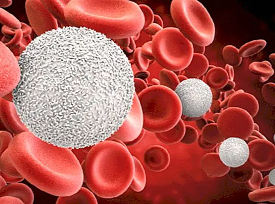 Monocitni test krvi: kaj je to in normalne vrednosti - medicinske preiskave