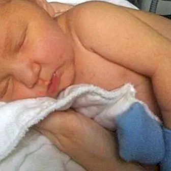 Bilirubin and jaundice in newborns