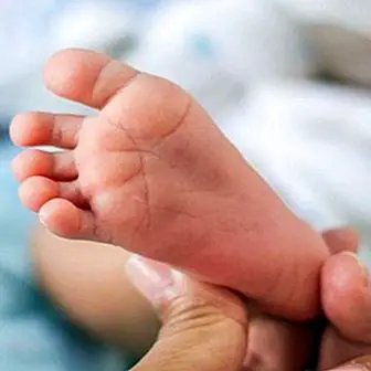 The heel test in the baby: what it is, how it is done and what it is for