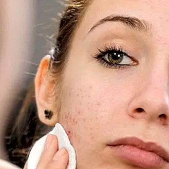 Allergia meikidele ja kosmeetikale: kuidas seda tuvastada ja mida teha