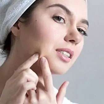 Perché l'acne appare nell'adolescenza e nella prevenzione