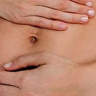 Kako smanjiti upalu debelog crijeva prirodno