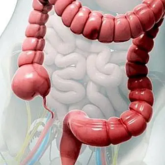 Peradangan usus besar: gejala dan penyebab paling umum