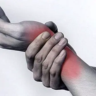 Tenosynovitis: keradangan sarung tendon. Gejala, sebab dan rawatan