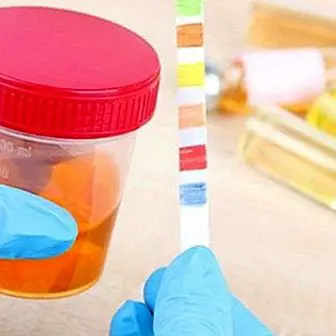 A cor da urina e seu significado médico