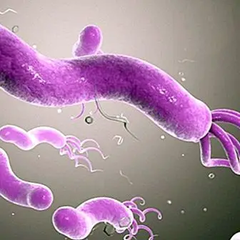 Apakah bakteria Helicobacter Pylori?: Gejala dan jangkitan