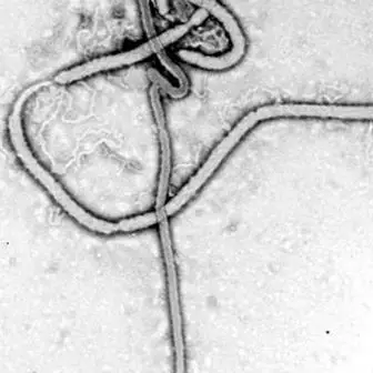 Ебола: що це таке, симптоми, діагностика, причини і лікування