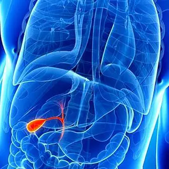 Removal or removal of gallbladder: everything you need to know
