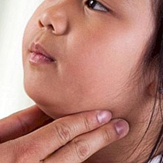 Mumps: aké sú príznaky, príčiny a liečba príušníc?