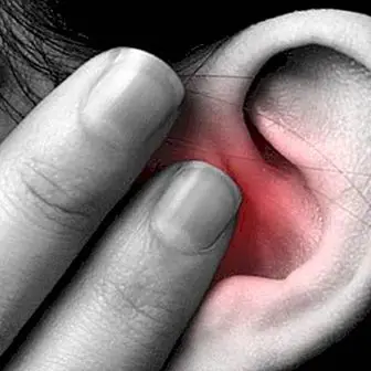 귀에 왁스 플러그가 있는지 확인하는 방법 : 증상