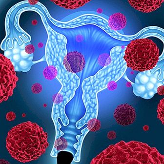Bolile principale ale ovarelor și simptomele de avertizare
