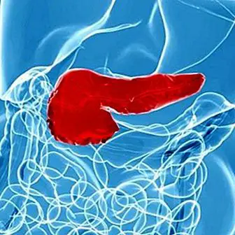 Pancreatite: sintomas, causas e tratamento