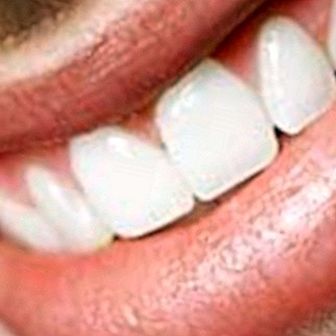 Dentes saudáveis: dicas para dentes saudáveis