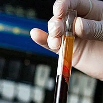 Hvordan kan blodprøven registrere 8 typer kræft