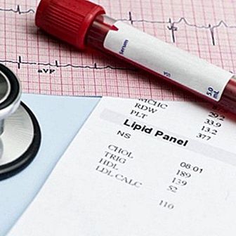 Test kolesterola u krvi: ukupno, LDL i HDL