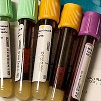 Vere pH: mis see on ja normaalväärtused