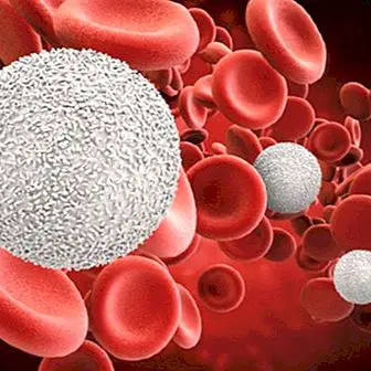 단핵구 혈액 검사 : 그것과 정상적인 값은 무엇인가?