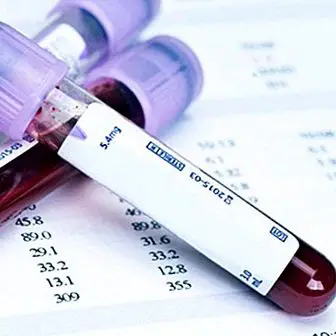 Triglyceride blood test: normal and abnormal values