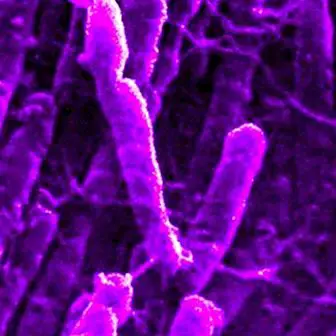 Clostridium Novyi: почвената бактерия, която може да помогне за лечение на тумори