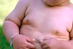 Como tratar a obesidade infantil em casa - bebês e crianças
