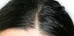 Petua semulajadi untuk mengurangkan gris rambut