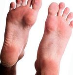 How to avoid hardness and calluses on the feet easily
